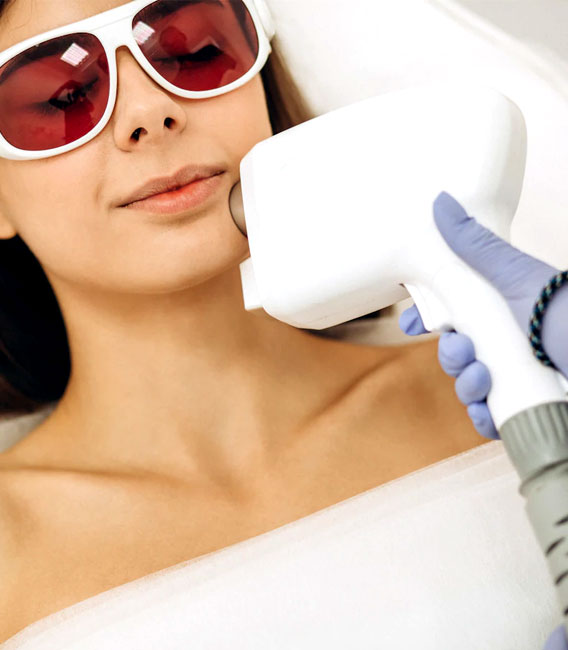 epilare definitiva laser faciala (mustata)